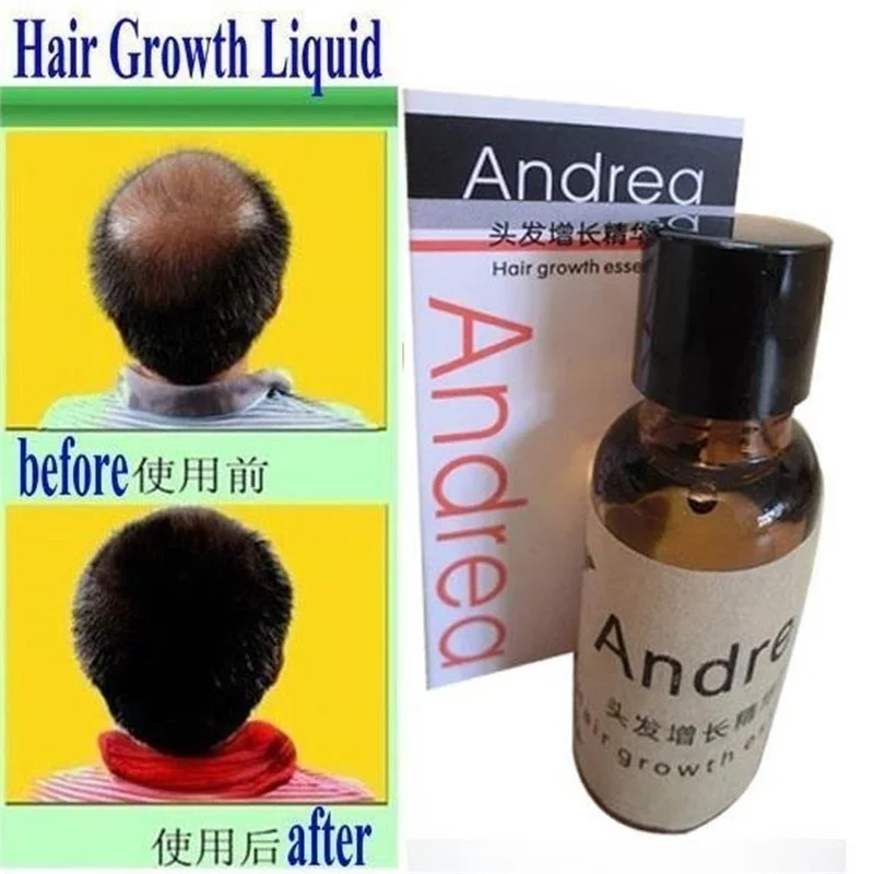 

Andrea Growth anti Hair Loss Liquid 20ml dense fast sunburst growth grow invalid refund alopecia
