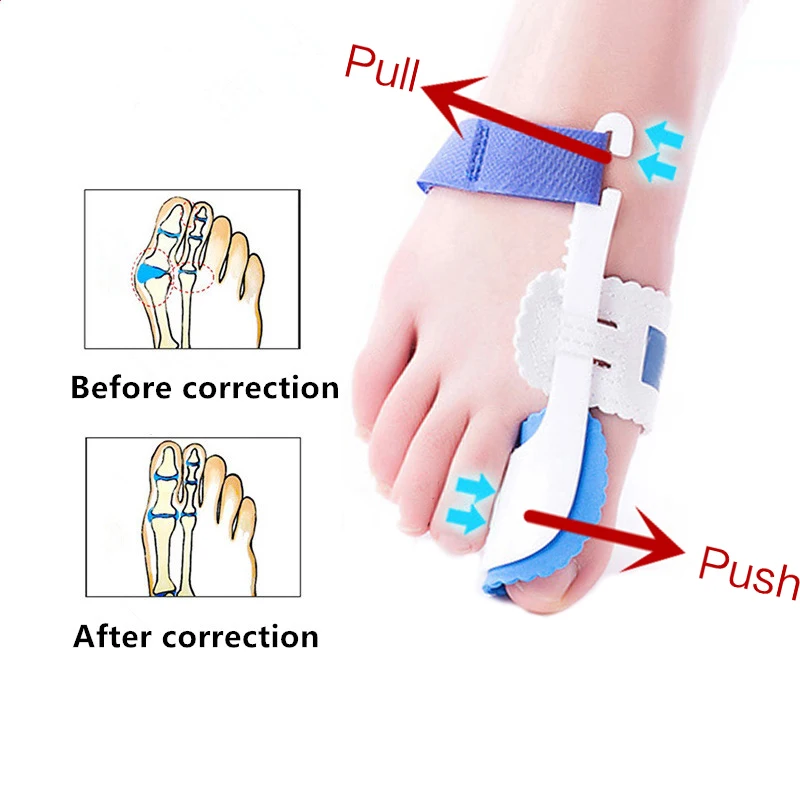 

1Pair Toe Separator Hallux Valgus Orthosis Bigfoot Bone Corrector Big Toe Overlapped Toe Divider Splint For Bunion Foot Care