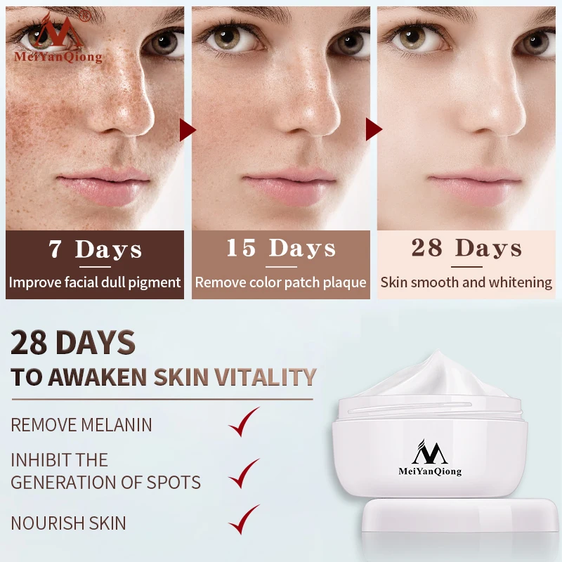 Powerful Whitening Freckle Cream Remove Acne Spots Melanin Dark Spots Face Lift Firming Face Skin Care Beauty Essentials-2