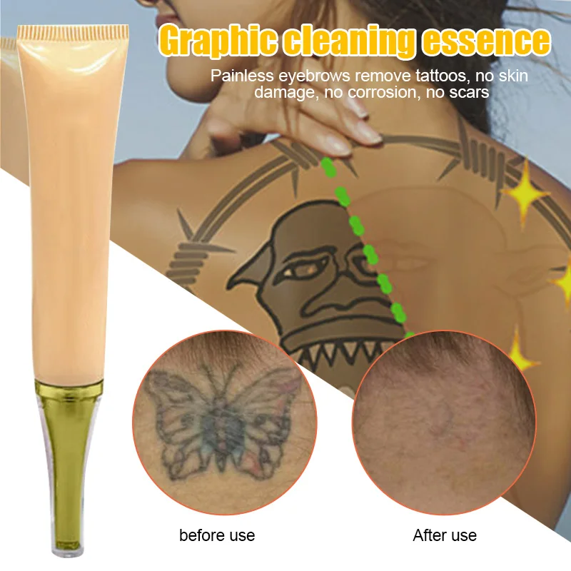 

Best Permanent Tattoo Removal Cream No Need For Pain Removal Maximum Strength QQ99