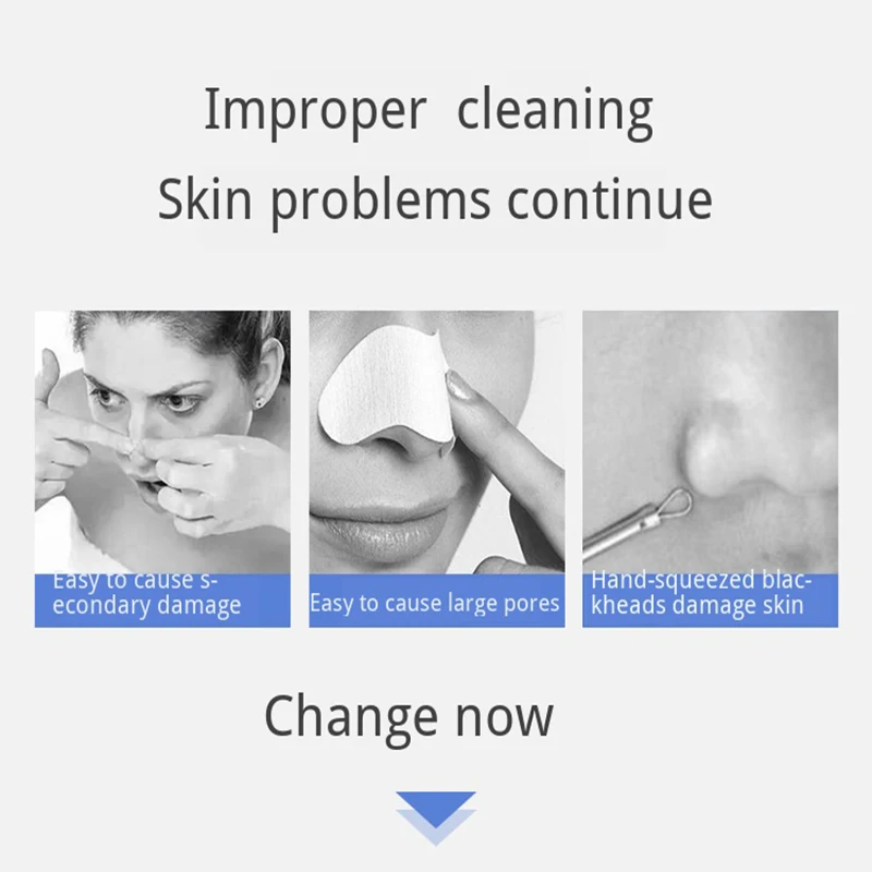 Aspirador de pó Visualmente Remover Cravos Preto hd Resolução Espinha Removedor Ferramenta Limpar Poros Vendo Eficácia Micro Câmera Dot 7 poros vendo eficácia micro câmera