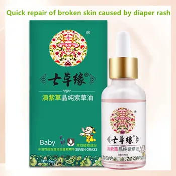 

Lithospermum baby oil baby diaper rash care broken skin burns and scalds insect/mosquito bites redness of skin adult available