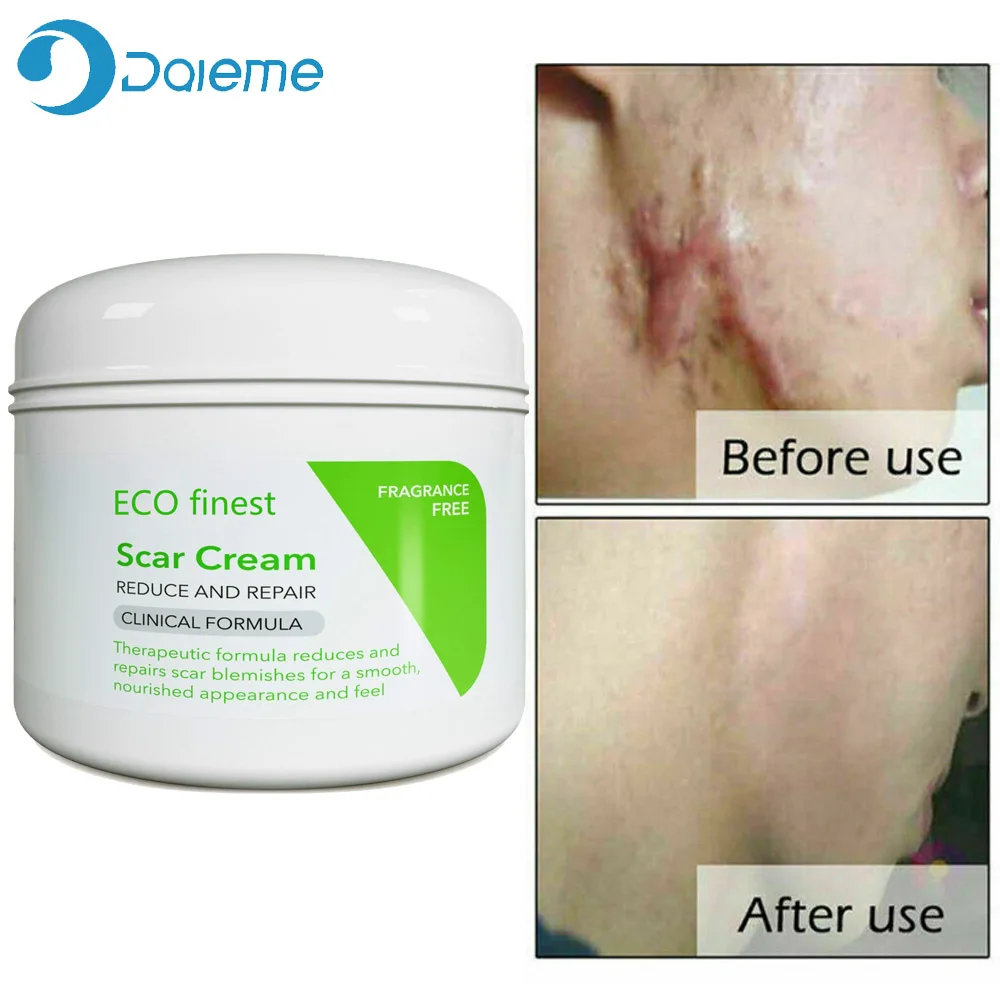 ECOfinest крем от шрамов для лица отбеливающий удаления беременности против морщин