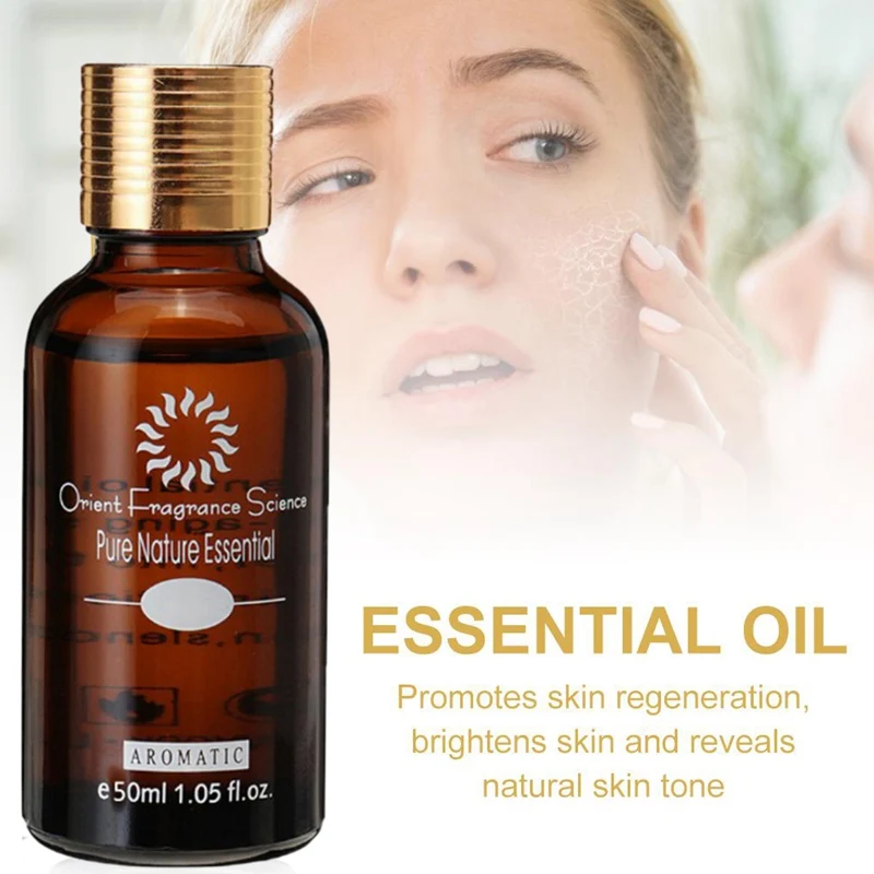 Горячее Отбеливающее эфирное масло для лица, масло без пятен, уход за кожей, темные пятна, удаляющая эссенцию от ожогов и растяжек