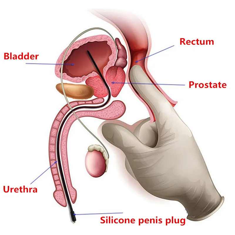 SM Electric Shock Penis Plug Ring Urethral Sounding Tube Dilator E-stim Prostate Medical Probe Urinary Man Gay Sex Toy Accessory — view 2