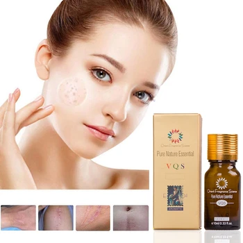 

10ml Lavender Essential Oil 100% Pure Basic Essential Oil removal Black spot Age spots Liver spot Acne-related brown spots