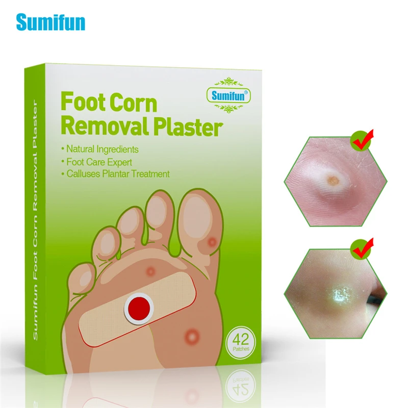 

Foot Corn Remover Patch Wart Thorn Curative Calluses Soft Feet Pain Relief Skin Treatment Medical Plaster Sticker Foot Care Tool