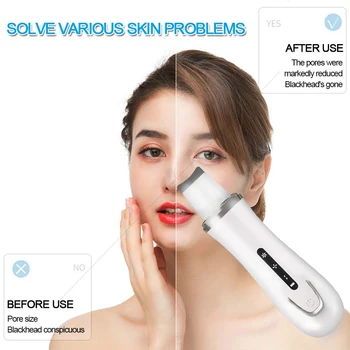 

Ultrasonic Ion Deep Cleaning Skin Microcurrent Scrubber Shovel Facial Pore Blackhead Cleaner Face Massager and Beauty Tools
