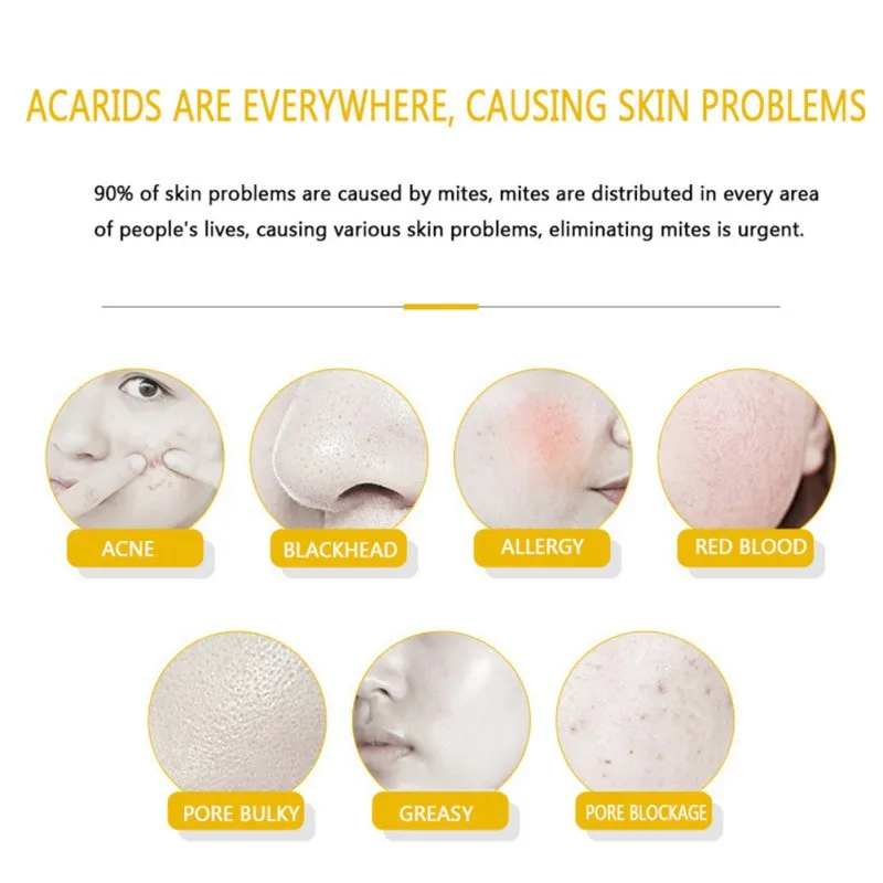 WXE 100% минеральной очистка и увлажнение серное мыло для очищающая для лица жирной грязи баланс выделение жира мыло формы новые