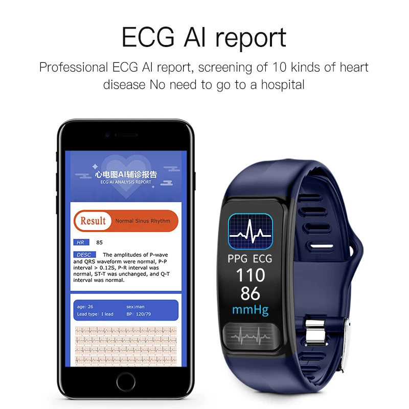  MKS Smartband Blood Pressure Smart Band Heart Rate Monitor PPG ECG Smart Bracelet Activity Fitness  - 4000182402342