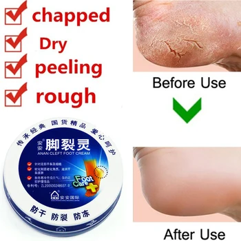 

Traditional Chinese Cosmetics Anti Dry in Heel Repair Foot Care Remove Dead Skin Soften Foot Care Cream Scrub Feet Heel Cream