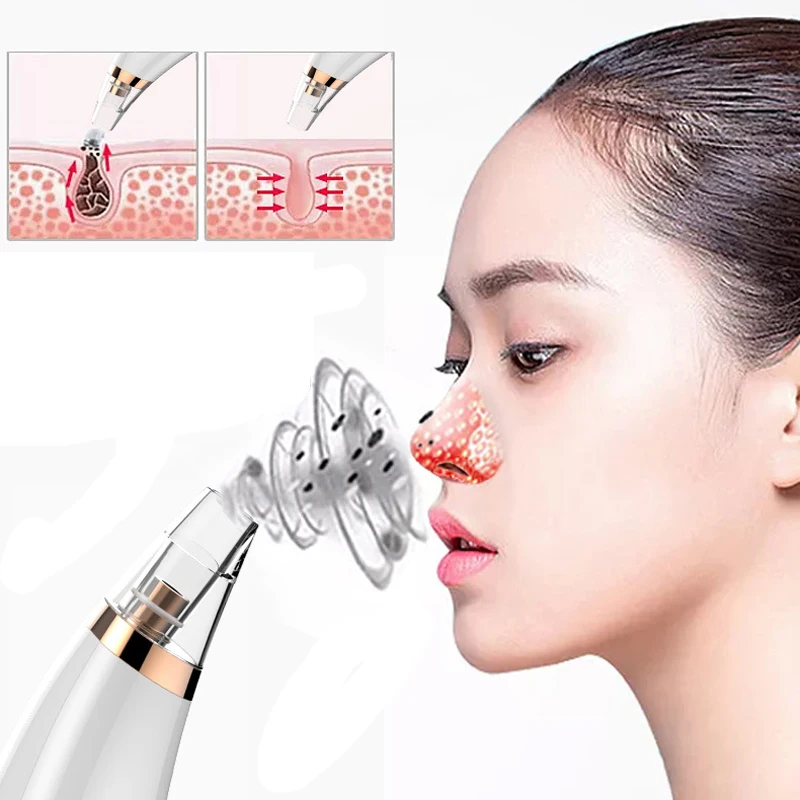 3 Vacuum Suction Heads Multifunctional Face Cleaning Device Electric Vacuum Black Head Remover Lighten Fine Wrinkles Oil Control