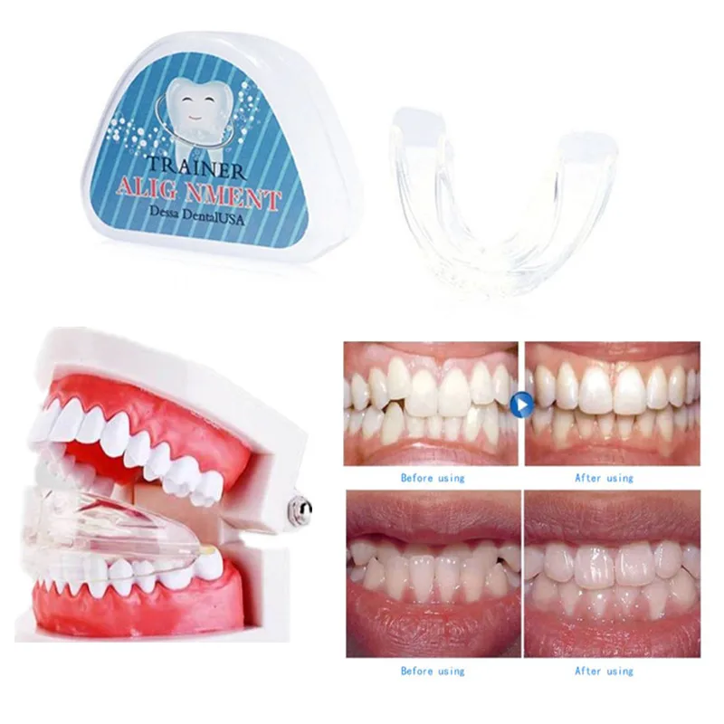 

Dental Tooth Orthodontic Appliance Trainer for Adults Alignment Braces 3 Phases Teeth Trainer Whitening Tools