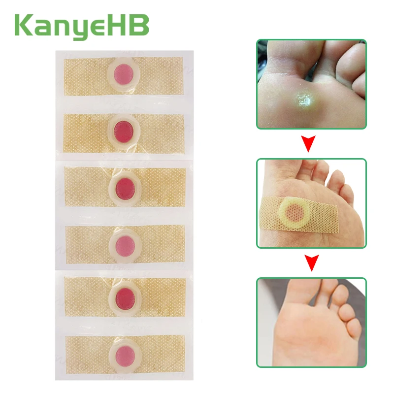 

30pcs Foot Care Stickers Medical Plaster Chicken Eye Corns Patches Medical Plaster Health Care Foot Corn Removal Patch A175