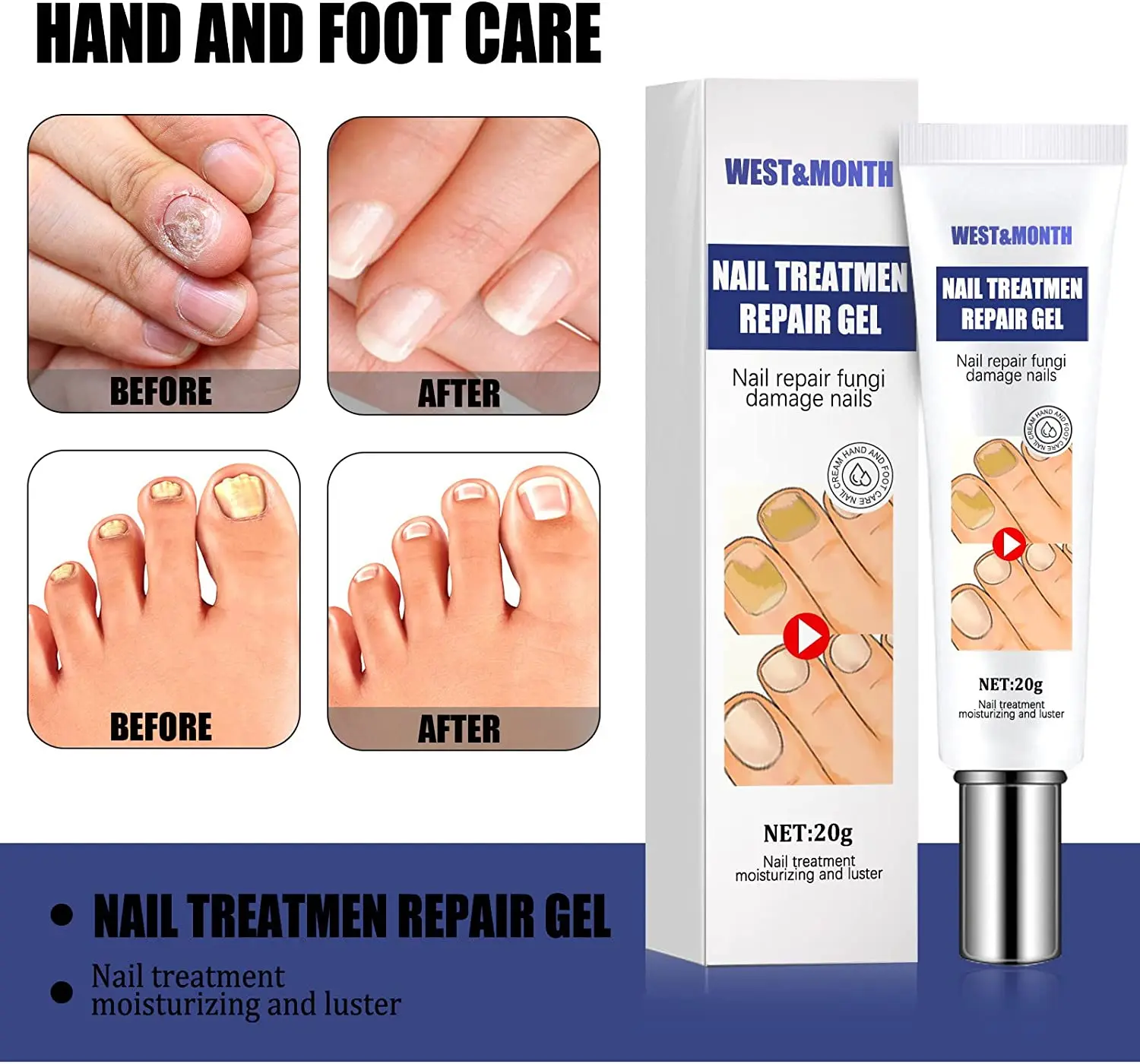 Top 119+ finger nail fungus ceg.edu.vn