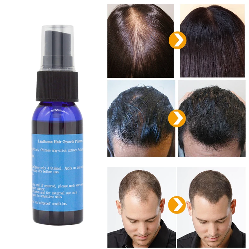 Уникальные 1 шт. быстрые средства для роста волос Плотные волосы regrowth essence treatment женщины и мужчины