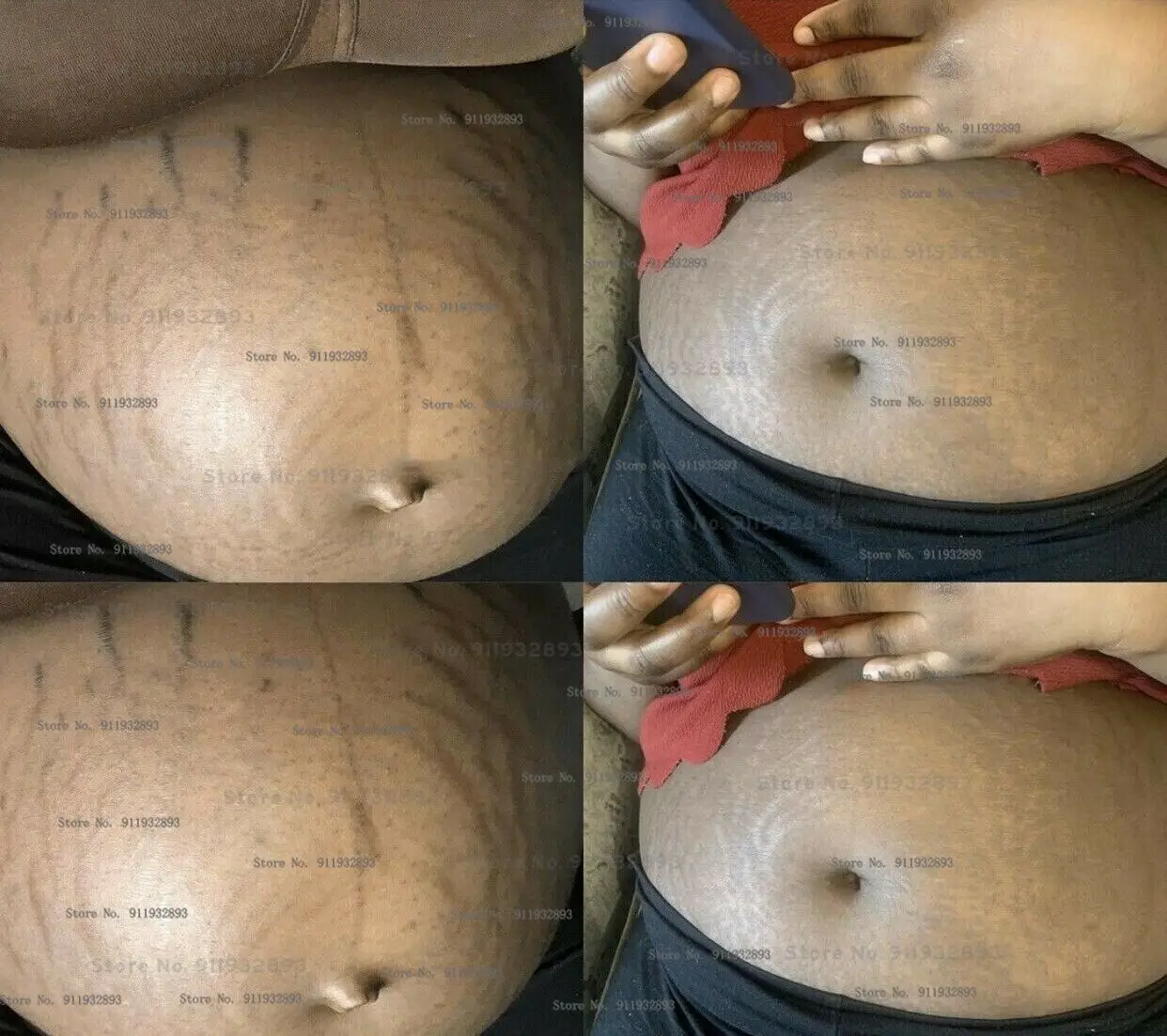 Women Private Intimate Bamboo Charcoal Vagina Whitening Scrub Mask Skin Cleansing Bleaching Remove Darkness Stretch Marks 2
