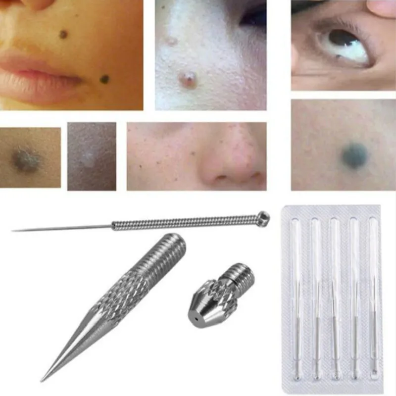 Facial Skin Care Tool Dark Spot Scar Remover Laser Plasma Pen Mole Tattoo Wart Removal Machine 1 Facial Skin Care Tool Dark Spot Scar Remover Laser Plasma Pen Mole Tattoo Wart Removal Machine 3