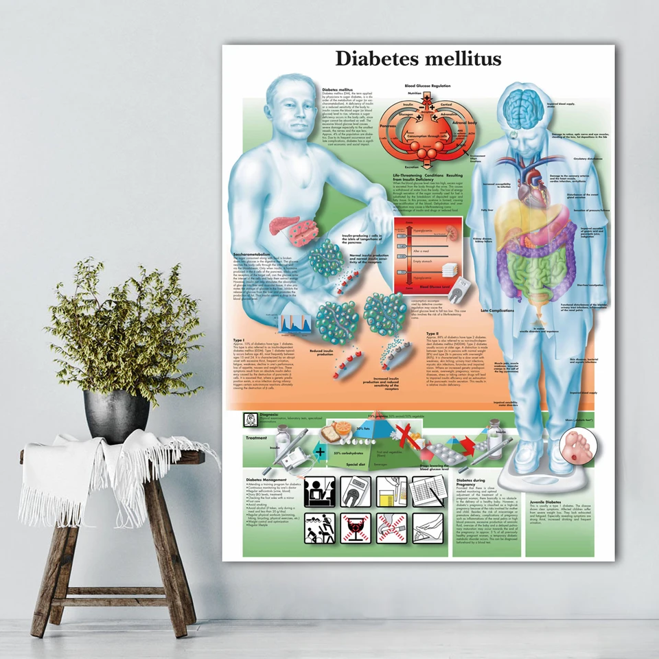 Poster Anatomico De Wangart Grafico De Diabetes Mellitus Lienzo Impreso Imagen De Pared Para Educacion Medica Aliexpress