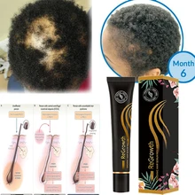 

Natural 20ml Natural Hair Growth Oil Thickener Essence Anti Hair Loss Care Scalp Massage Roller Treatments Fast Grow Hair Serum