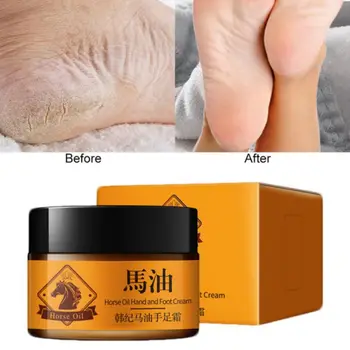 

Horse Oil Feet Cream Heel Cream for Athlete's Foot Feet Mask Itch Blisters Anti-chapping Peeling for Foot Care Cream Hot