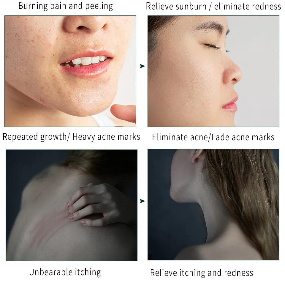 アロエジェル保湿カプセル50ml 鎮静スキンケア オイルコントロール 日焼け後の保湿日焼け止め スキンリペアローション トリートメント マスク Aliexpress カプセル アロエベラジェル 保湿 保湿 日焼け後リペア ジェルローション 50ml Ciudaddelmaizslp Gob Mx アロエジェル保湿カプセル50ml 鎮静スキンケア オイルコントロール 日焼け後の保湿日焼け止め スキンリペアローション トリートメント マスク Aliexpress カプセル アロエベラジェル 保湿 保湿 日焼け後リペア ジェルローション 50ml Ciudaddelmaizslp Gob Mx