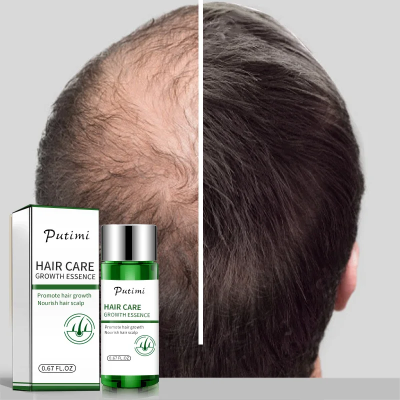 PUTIMI питательная сыворотка для роста волос для женщин и мужчин, предотвращающая выпадение волос, эффективная восстанавливающая Уход за волосами, уход для мужчин t 20 мл