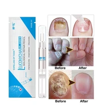 1/2/4 шт Анти-грибковые лечения Ногтей ручка онихомикоз паронихии инфекции травяные палец ремонт ногтям здоровье Красота инструмент