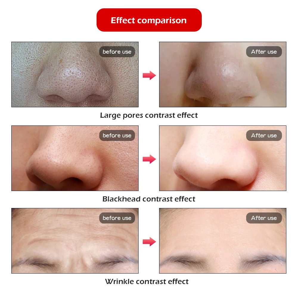  7 Colors PDT Led Facial Mask Photon Light Therapy Skin Rejuvenation Device Spa Acne Remover Anti-Wr - 4000296118744