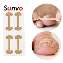 4 шт. корректор вросшего пальца для ухода за ногтями, уход за пальцами, коррекция ногтей, коррекция, восстановление, пластырь, вкладыши для ног, Прямая поставка