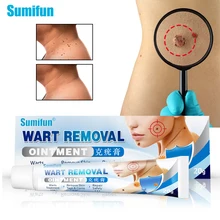 Sumifun 20g Wart Cream Skin Tag Remover Antibacterial Cream Micro Ointment Mole Wart Body Face Care Herbal Extract Ointment