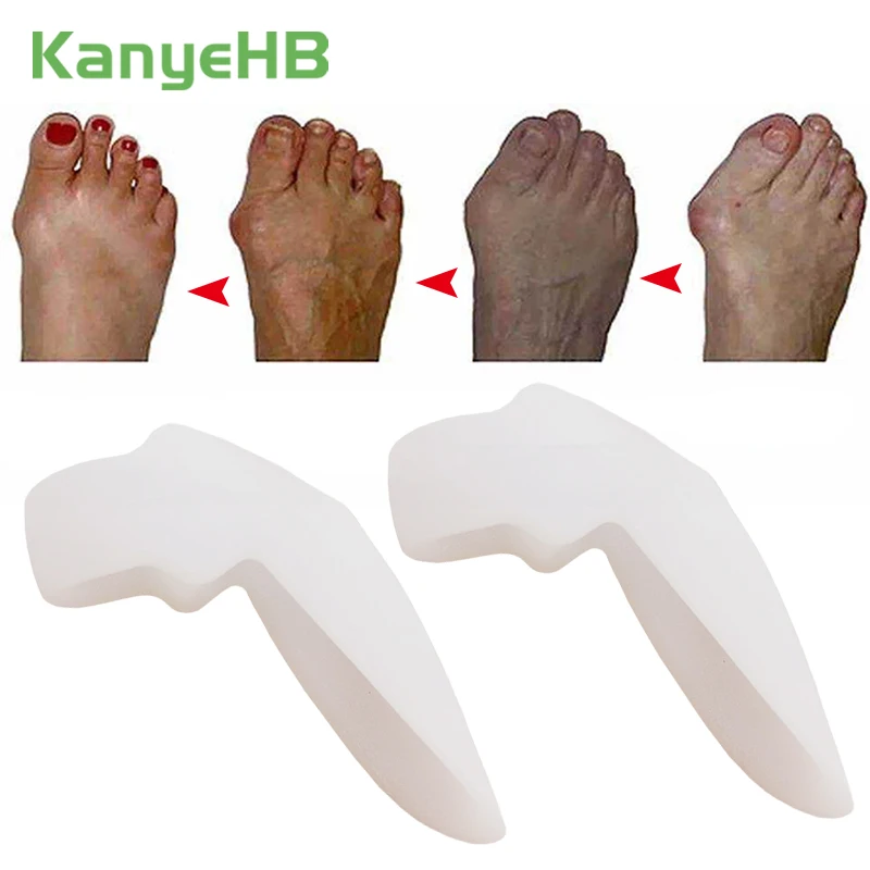 2Pcs Big Toe Bone Straightener Thumb Valgus Protector Silicone Gel Foot Care Fingers Toe Separator Bunion Adjuster Feet Massager