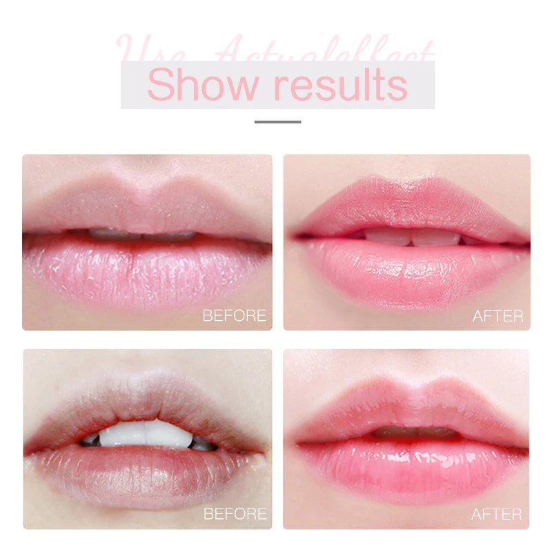 12/20PCS Crystal Collagen Cherry Lip Mask Hydrating Moisturizing Essence Gel Patches Lip Masks Lip Care Enhancer Pads Patches