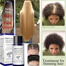 Productos anticaída del cabello