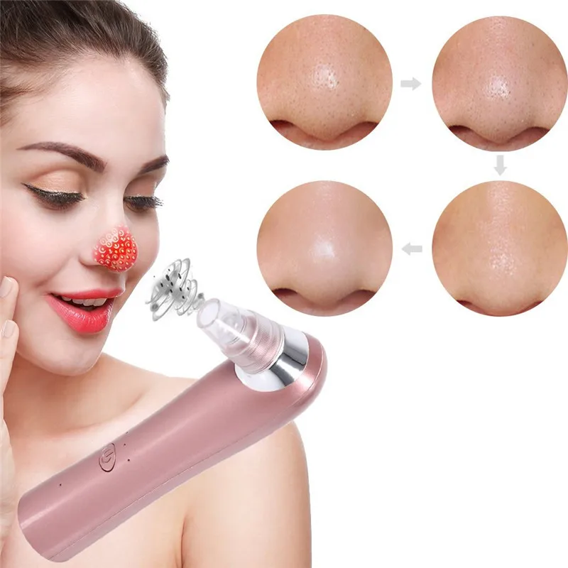 

Facial Blackhead Remover Vacuum Dead Skin Acne Pore Peeling Device Cleaning Skin Beauty Tool Suck Out Blackhead Plug-in Machine