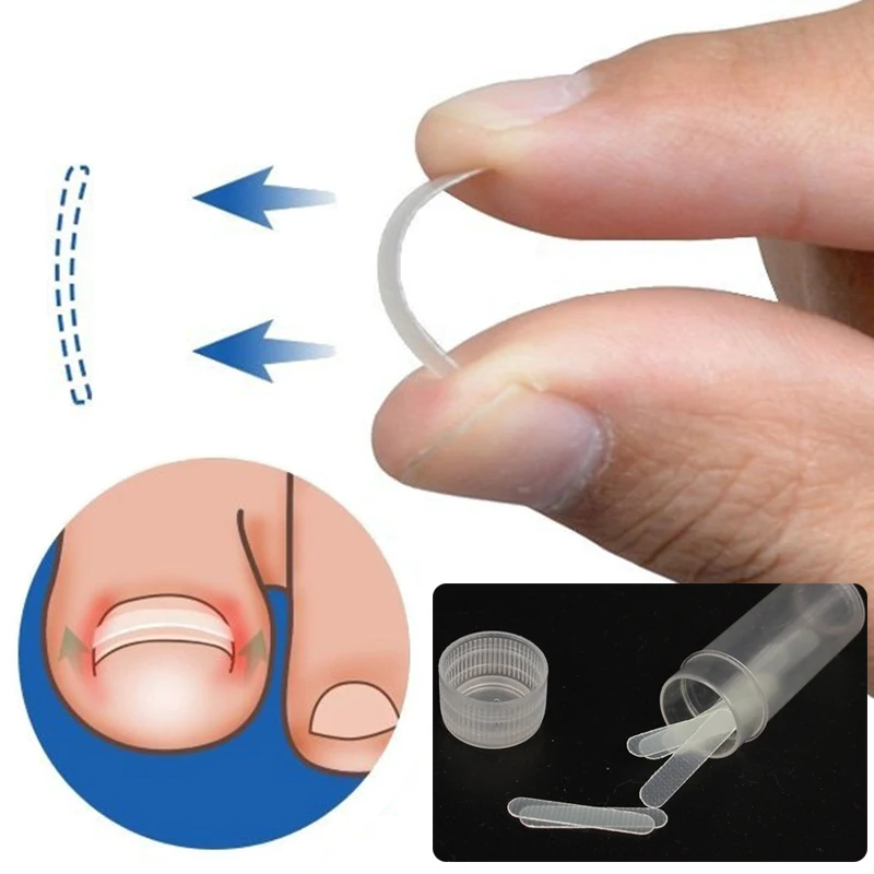 10pcs Nail Treatment Ingrown Toenail Correction Toe Elastic Patch Sticker Straightening Clip Brace Pedicure Care Tool | Красота и
