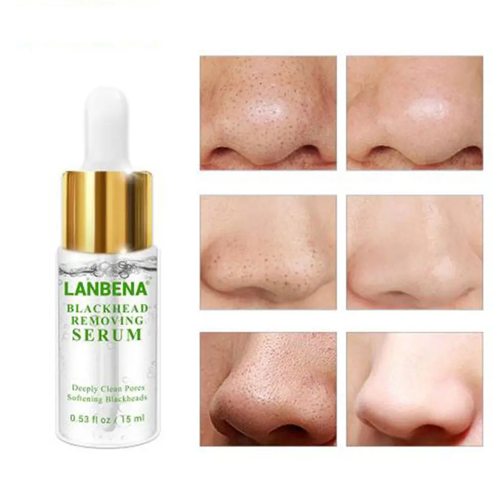 blackhead deep cleansing solution