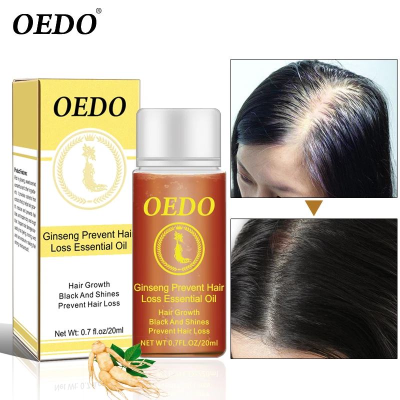 OEDO, экстракт женьшеня, эссенция для роста волос, масло против выпадения волос, быстрая мощная продукция для волос, густая, быстрая реставрация, средство для лечения скала, горячая Распродажа, 20 мл