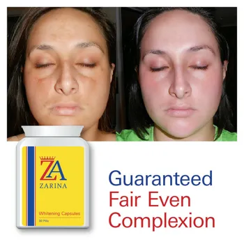 

ZARINA WHITENING CAPSULES PROVEN WHITE LIGHT FAIR SKIN EXTREME RESULTS FAST!