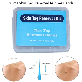 

30Pcs High Quality Skin Tag Removal Rubber Bands Micro Band Non Toxic Face Care Mole Wart Skin Care Tools