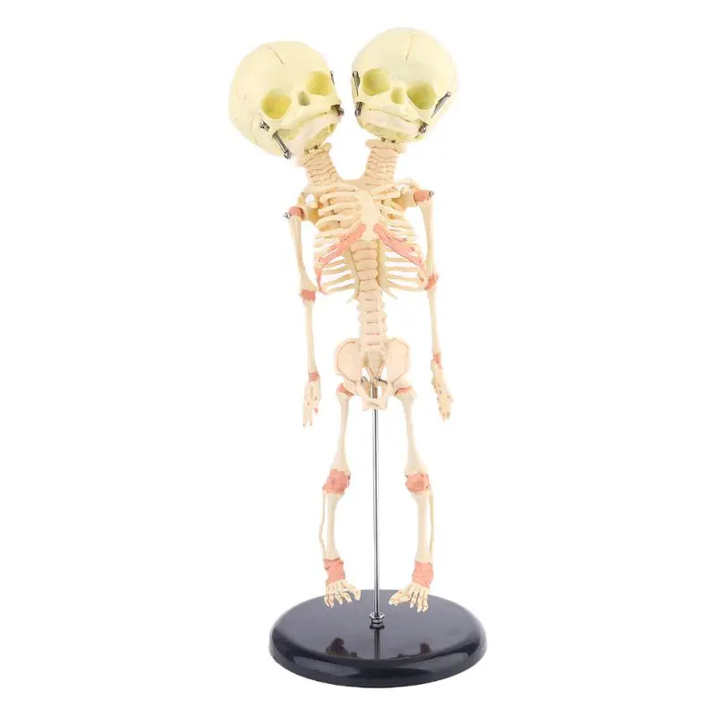 

Human Double Head Baby Skull Research Model Skeleton Anatomical Brain Anatomy Teaching Study Display