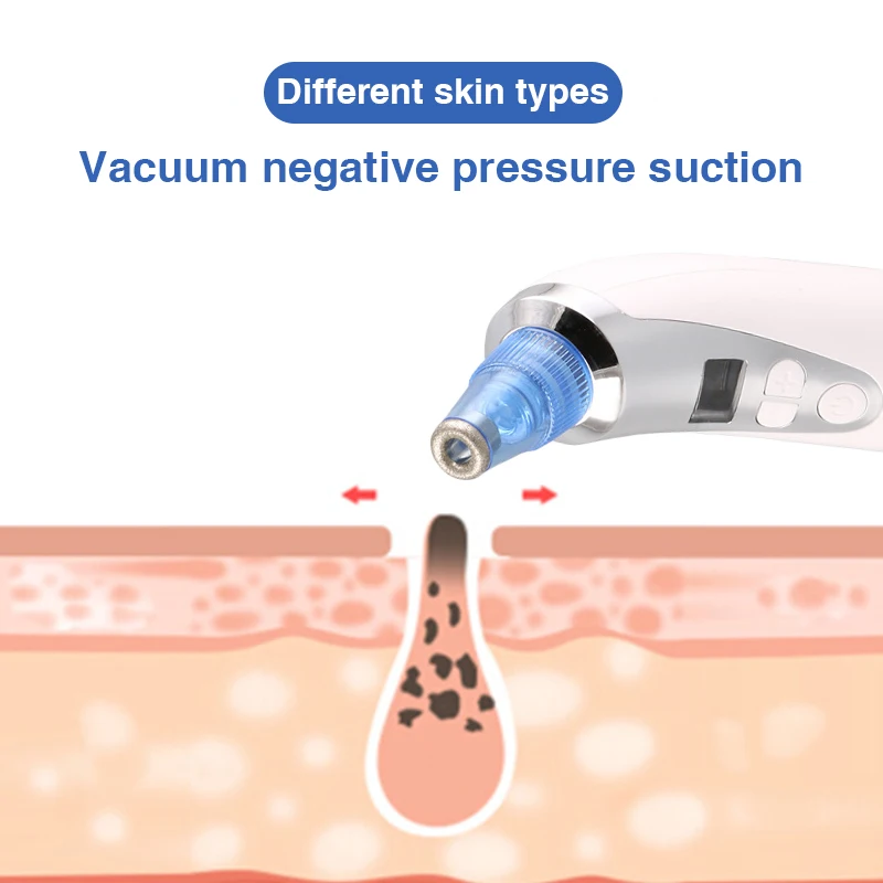 Электрический чистка лица пилинг для лица микрокристаллический пылесос для удаления угрей лица и черных точек, Вакуумный Пылесос Для Удаления пор и черных точек, инструменты для ухода за кожей от прыщей