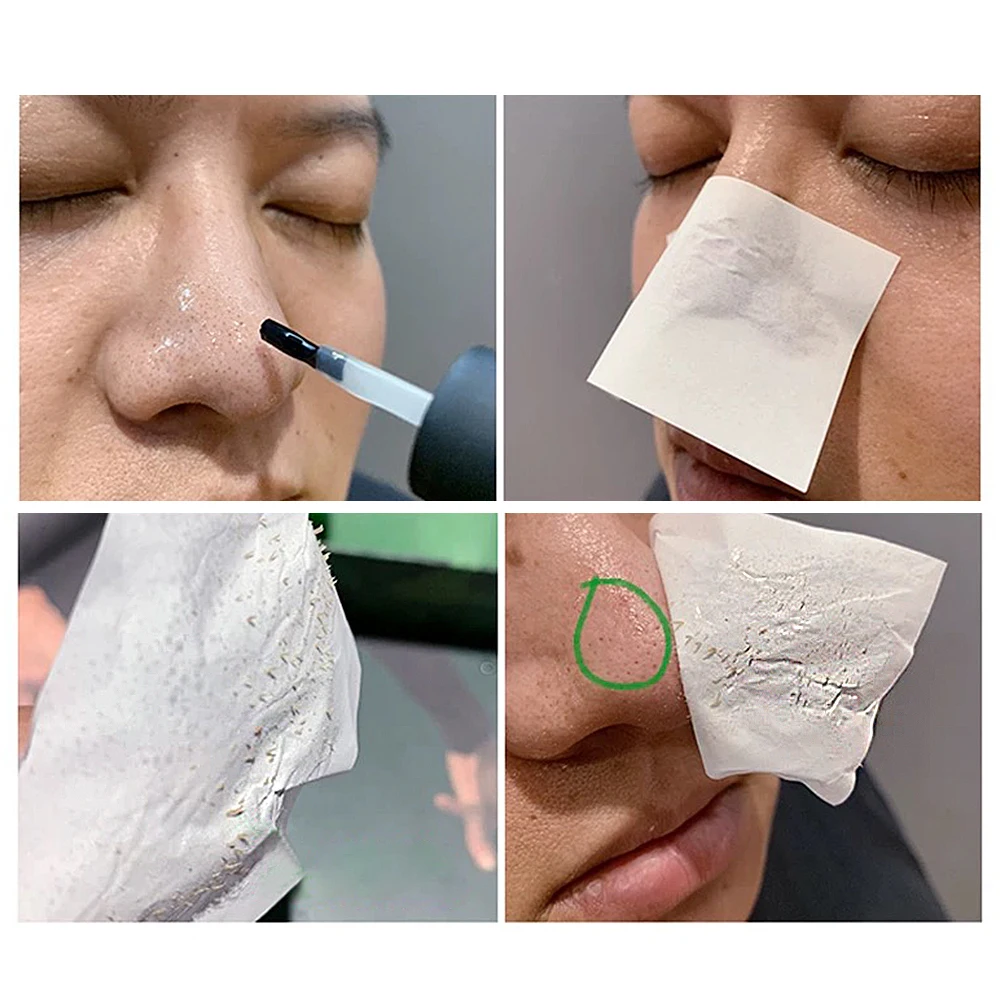 Маска для носа Breylee Blackhead Очищающий отшелушивающий крем лица маска лечения акне