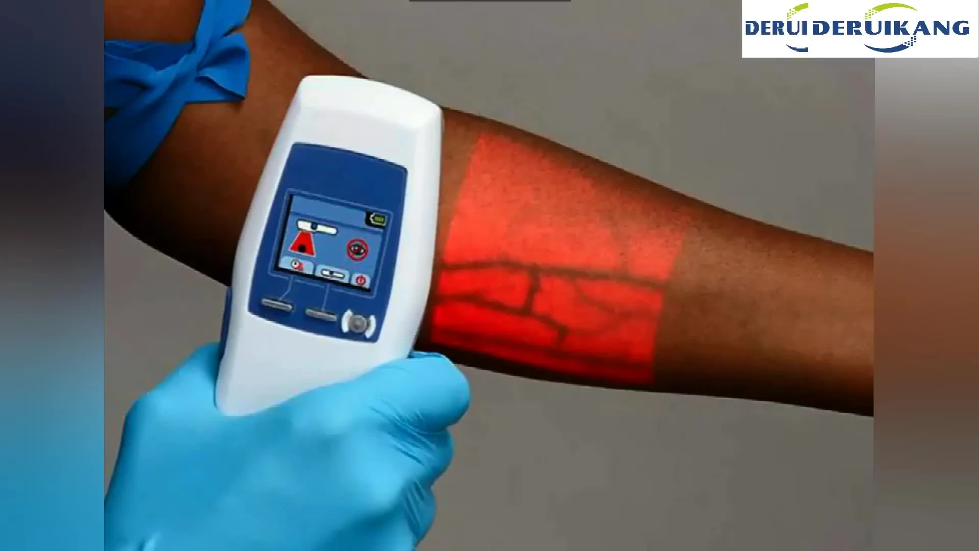 Accuvein av400 прибор для визуализации вен. Accuvein av300. Accuvein av400 (accuvein av300)):. обнаружение вен. обнаружение вен.