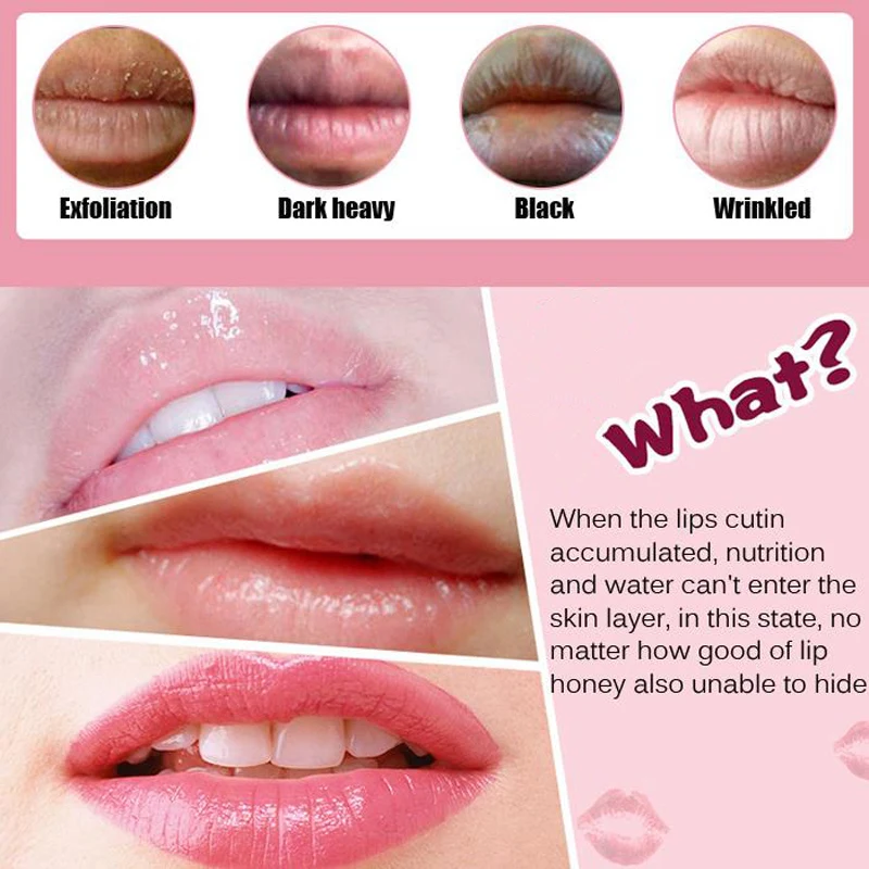 1Pcs Lip Gel Mask Hydrating Repair Remove Lines Blemishes Lighten Lip Line Blemishes Mask to Moisturize Protect Lips Care