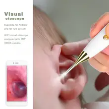 WF-500 IP67 1280x720 Wi-Fi визуальный отоскоп ушной инспекционной камеры 1MP эндоскоп инструмент для чистки ушей 30FPS камера эндоскопа