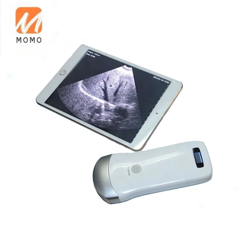 

Mini wireless wifi ultrasound / convex echo usg MSLPU31