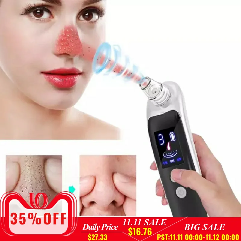 

Vacuum Nose Blackhead Remover Black Spot Dots Whitehead Pimple Removal Suction Machine Rechargeable Pore Cleaner Facial Tools