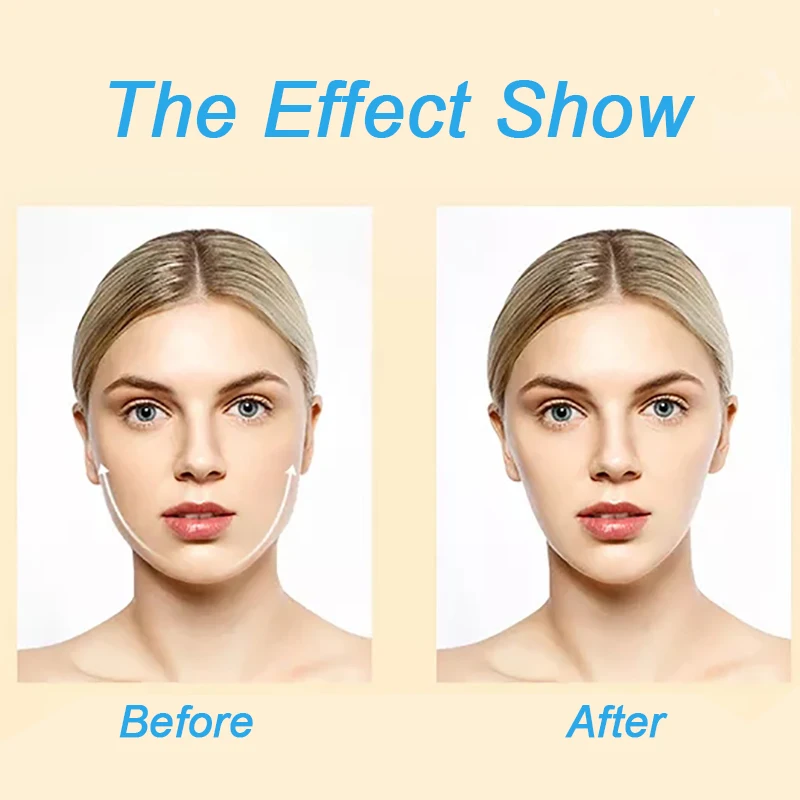 Facial para Clarear Compacta da Ascensão dos Pontos para a Forma da Cara de v o Ácido Hialurónico do Grupo do Rejuvenescimento da Pele Remove Enrugamentos Acne Energia 8 da pele facial para clarear remove enrugamentos,