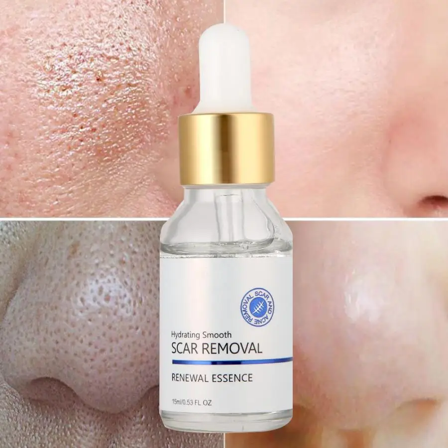 Laser Hair Removal Machine 15ml Anti Acne Face Serum Face Lifting Skin Care Acne Removal Treatment Face Cream Jade Roller